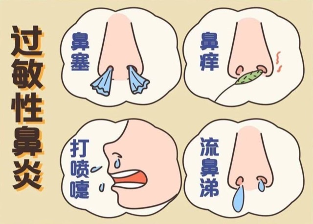 春季远离过敏性疾病:如何治疗过敏性疾病 春季远离过敏性疾病:如何治疗过敏性疾病