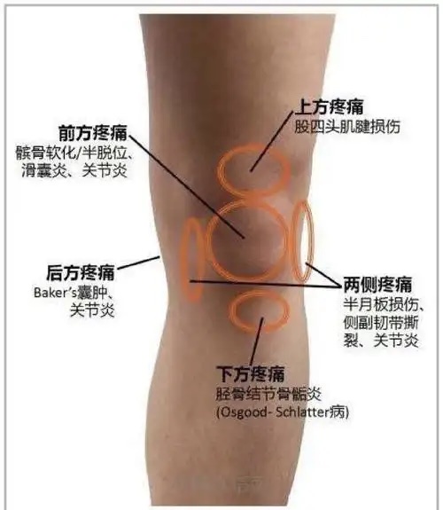 关爱老年人:关节炎与骨质疏松的防治之道 关爱老年人:关节炎与骨质疏松的防治之道
