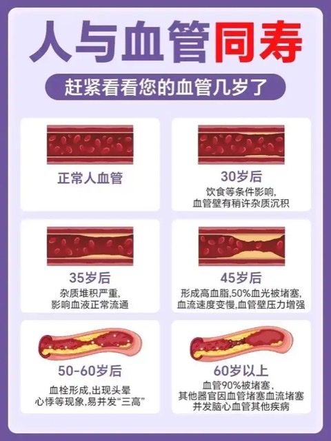 解密:血管健康为何等同寿命长度 解密:血管健康为何等同寿命长度