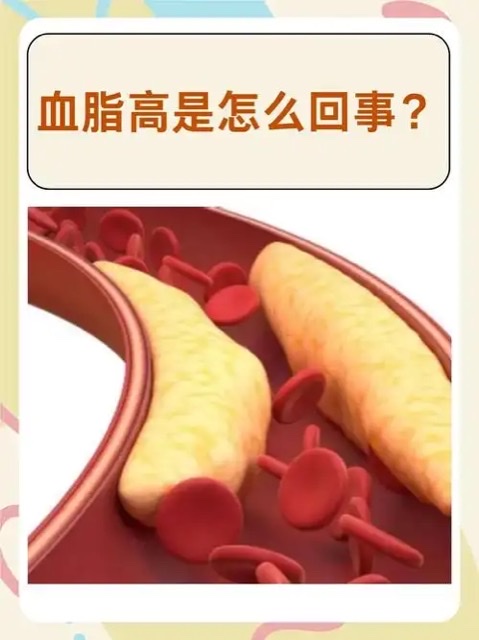 警惕!“血管杀手”——血栓偏爱这些人 警惕!“血管杀手”——血栓偏爱这些人