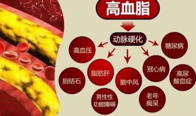 警惕!“血管杀手”——血栓偏爱这些人 警惕!“血管杀手”——血栓偏爱这些人