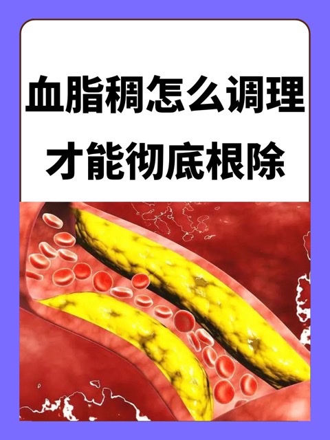 警惕!“血管杀手”——血栓偏爱这些人 警惕!“血管杀手”——血栓偏爱这些人