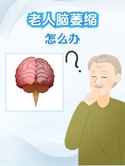 没有这个习惯的人更容易脑萎缩!送你健脑小秘诀,远离痴呆身体棒 没有这个习惯的人更容易脑萎缩!送你健脑小秘诀,远离痴呆身体棒