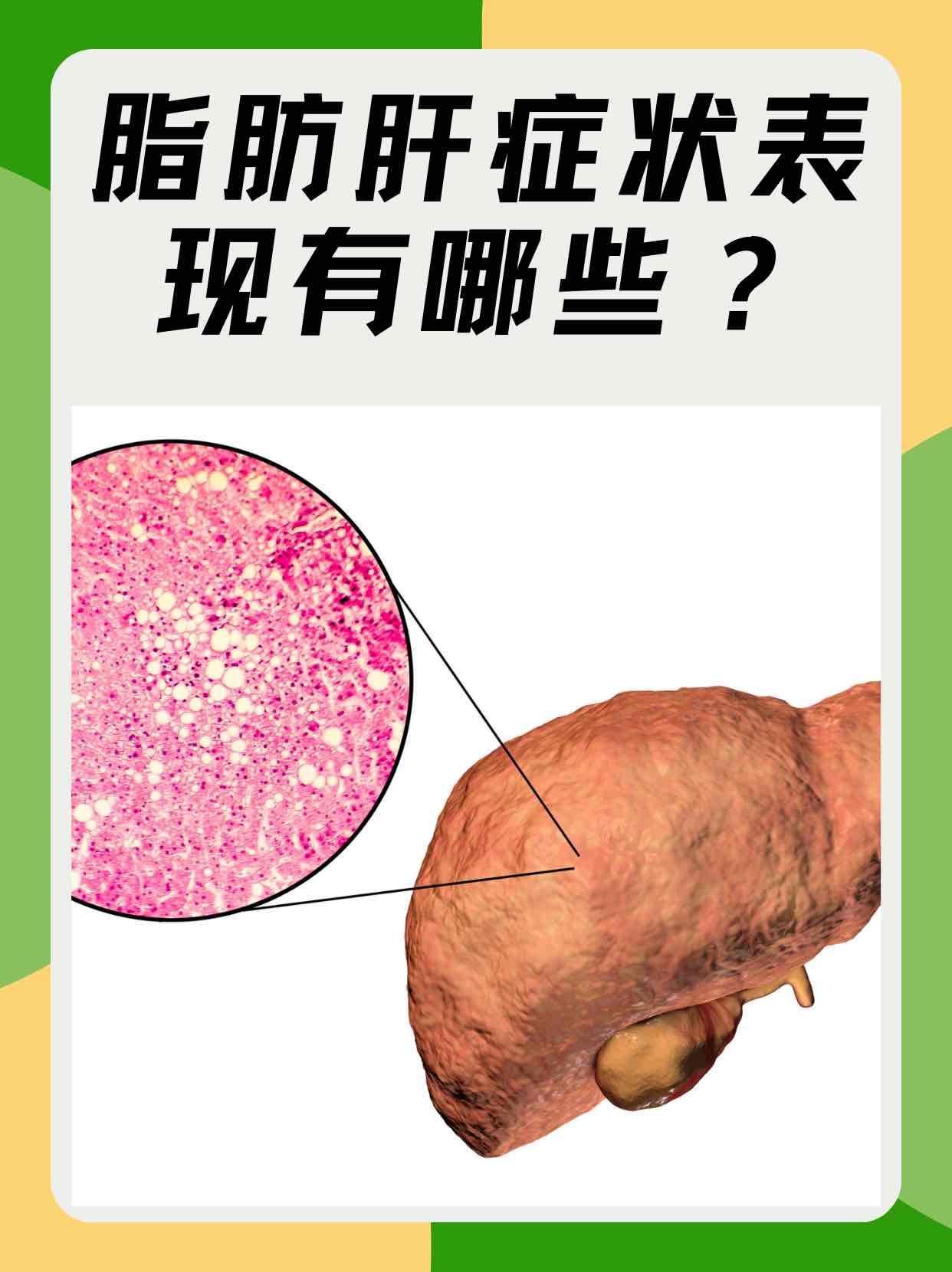 ֬λע⣺ٺȾֻǻ⼸ʳ