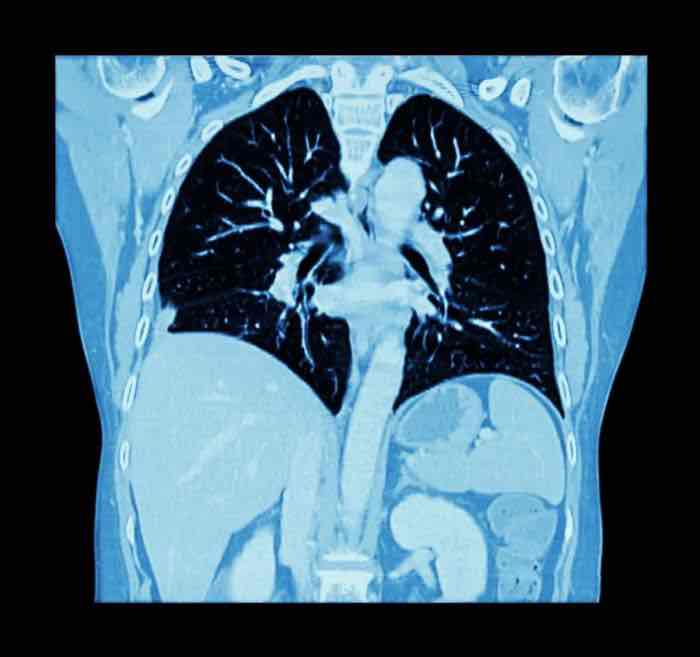 体检查出结节怎么办?避开误区,这样应对最科学 体检查出结节怎么办?避开误区,这样应对最科学