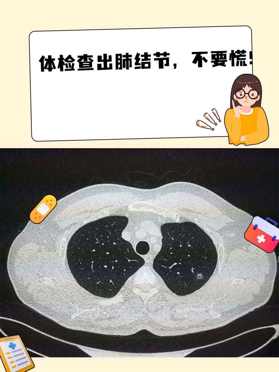 体检查出结节怎么办?避开误区,这样应对最科学 体检查出结节怎么办?避开误区,这样应对最科学