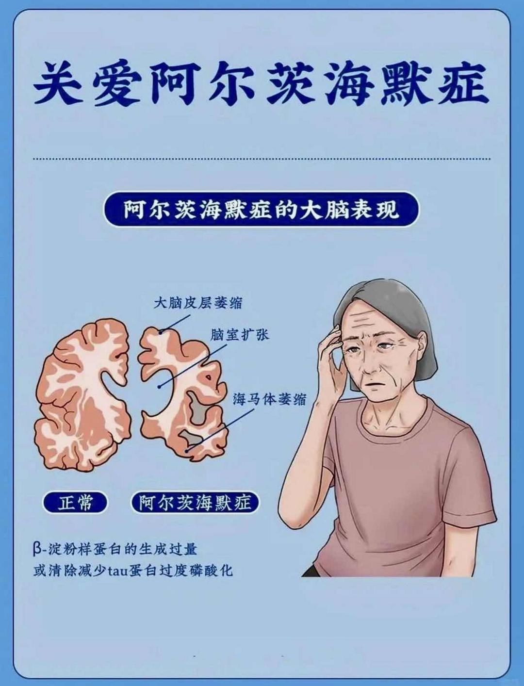 别让“遗忘”偷走晚年:阿尔茨海默病的早筛、早治与守护之道 别让“遗忘”偷走晚年:阿尔茨海默病的早筛、早治与守护之道