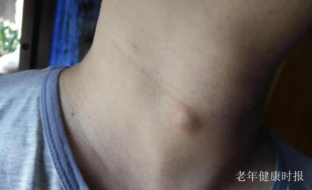 ҽ������棺��Щ��ʳ��ǽ�ڵġ��߻�����