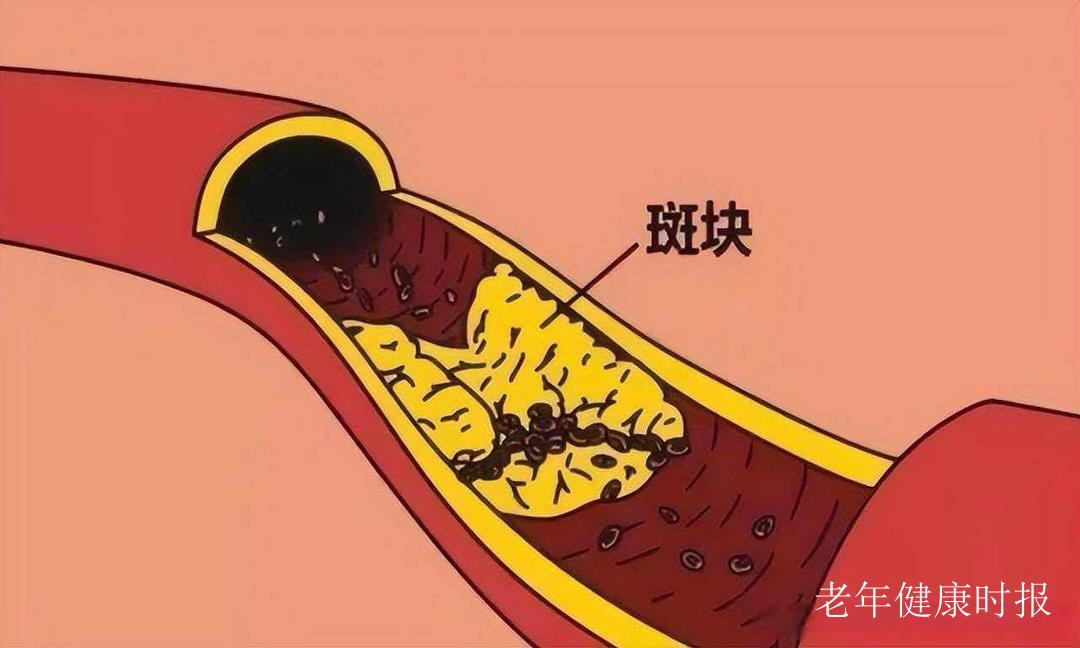 Ѫ����ġ����ε��ˡ����߿鲻�۲�����Σ��ȴ��С