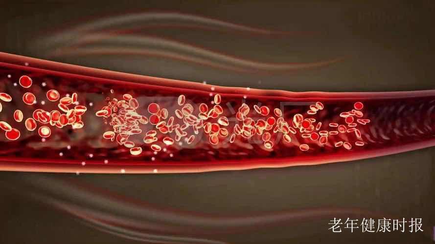 你的“坏胆固醇”可能早已超标!血脂“安全线”再度收紧 你的“坏胆固醇”可能早已超标!血脂“安全线”再度收紧