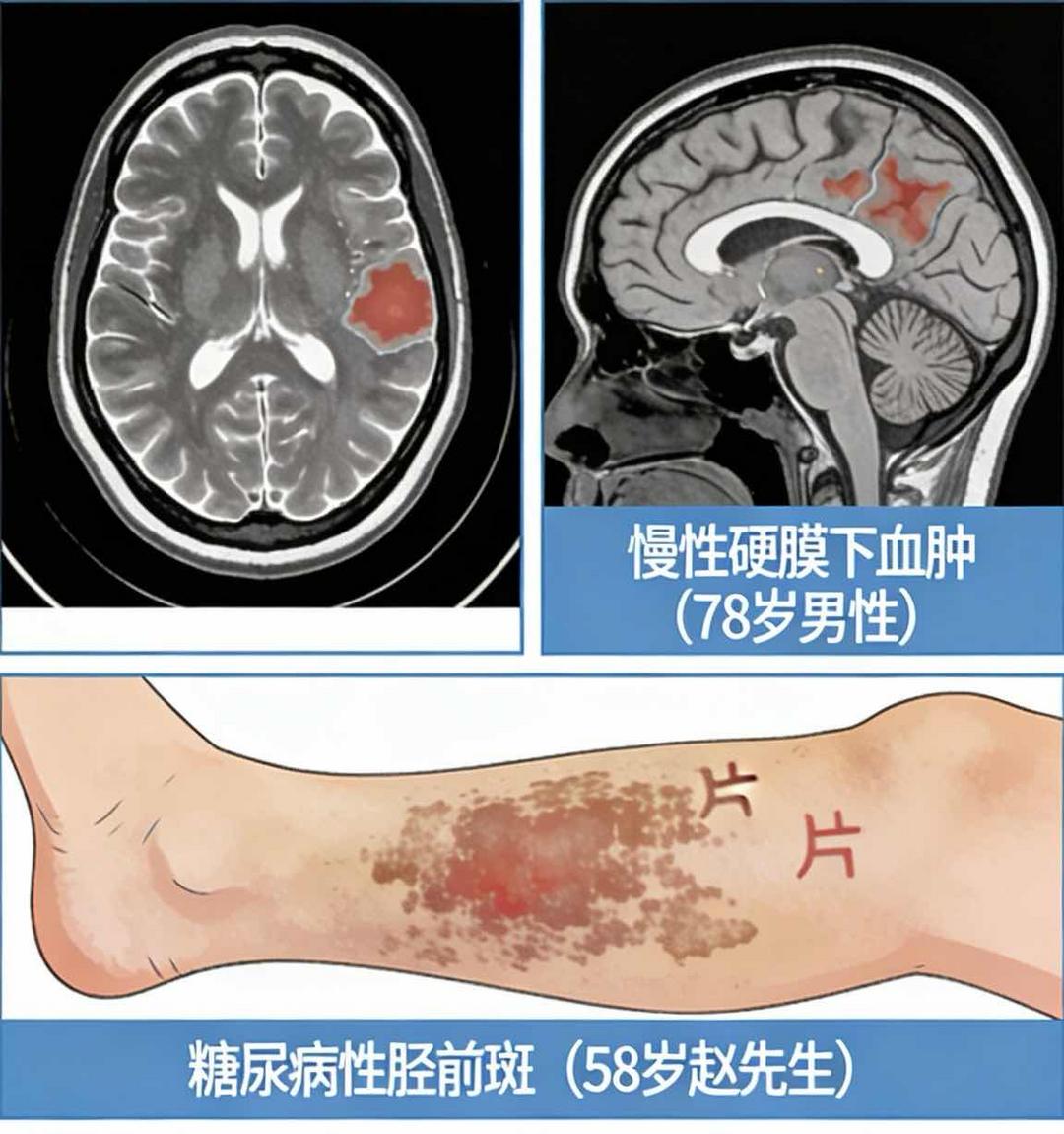 ���ڡ��Ϻ�Ϳ���͡�Сë���������Σ��